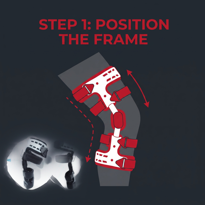 Adjustable OA Unloader Knee Brace - how it works step 1 position the frame